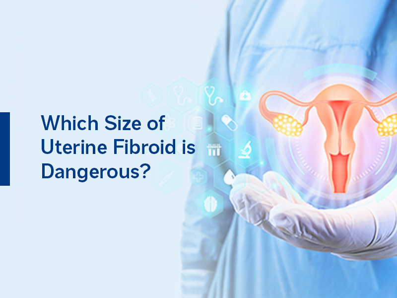 Uterine Fibroid